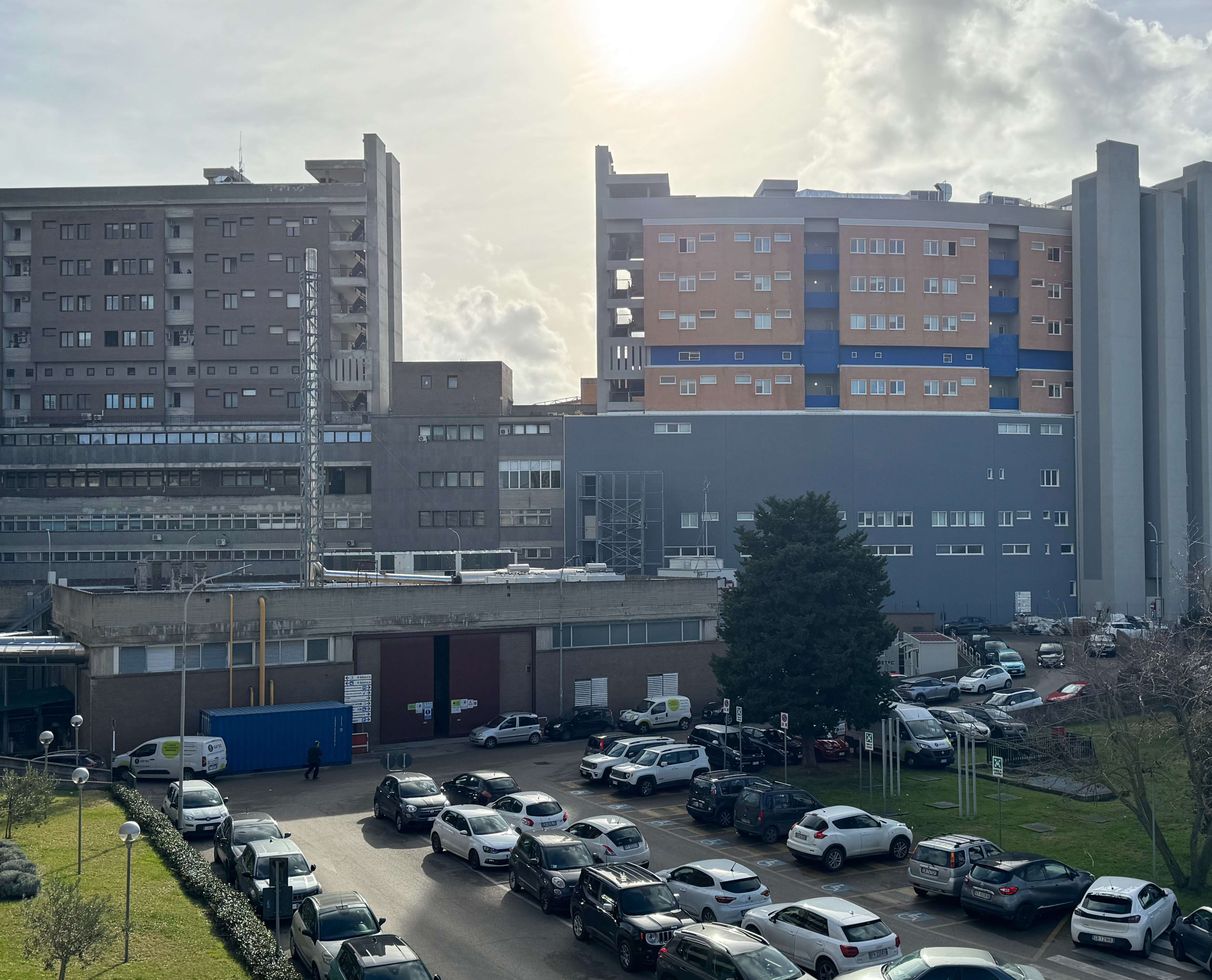 Ospedale Santa Rosa: eseguita complessa vitrectomia con impianto di cristallino artificiale a fissazione iridea